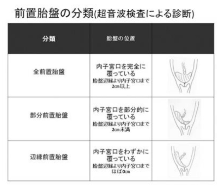 子宮 妊娠 口 初期