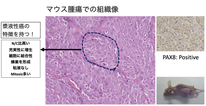 図３　卵管采不死化細胞から漿液性癌を作成